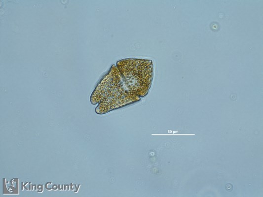 Photo of Akashiwo sanguinea